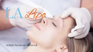 Woman receiving Actinic Keratosis Removal Treatment North Acton