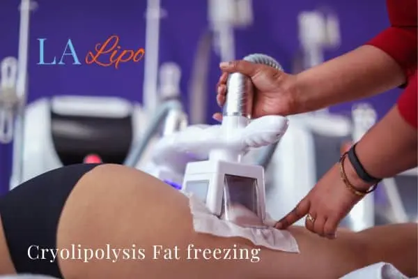 women getting fat freezing North Acton