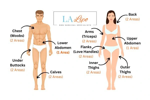 LA LIPO Cryolipolysis Areas North Acton