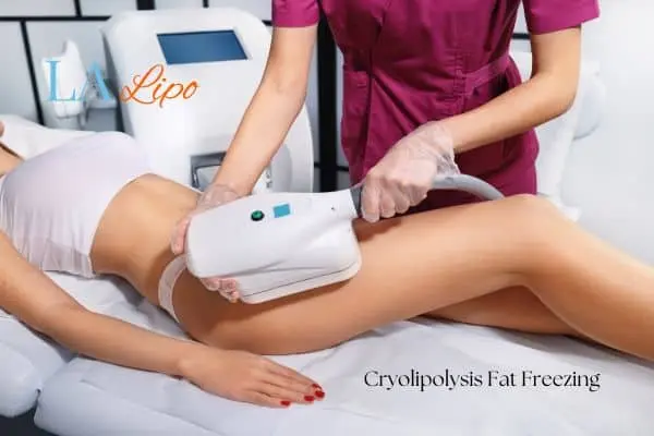 Woman receiving coolsculpting North Acton treatment on her thighs