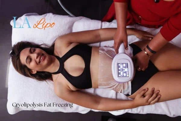 woman getting cryolipolysis North Acton